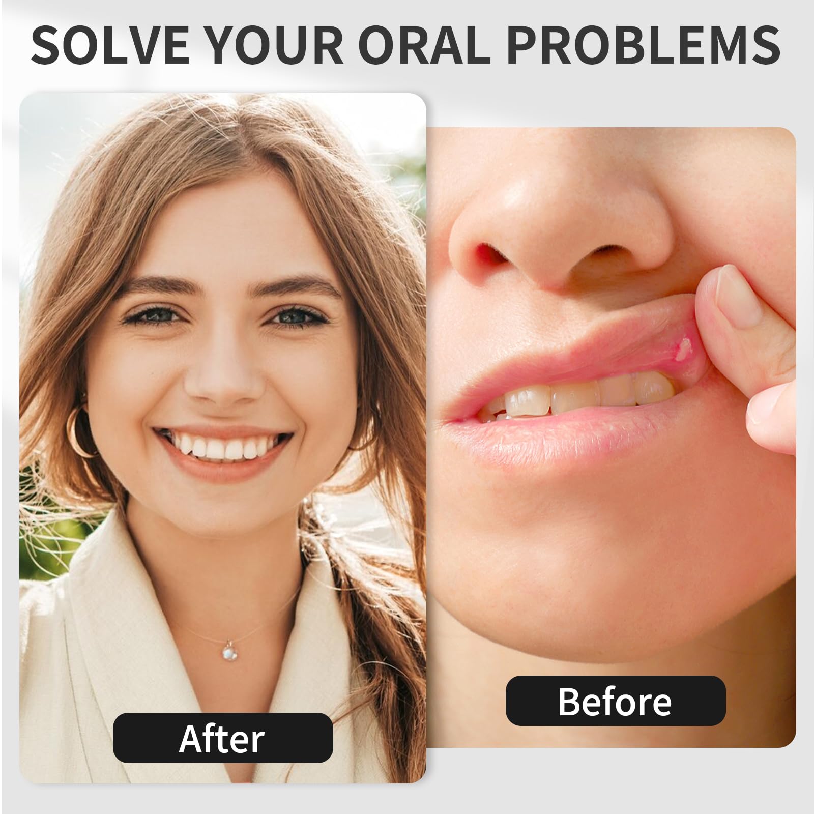 Red Light Oral Therapy Device