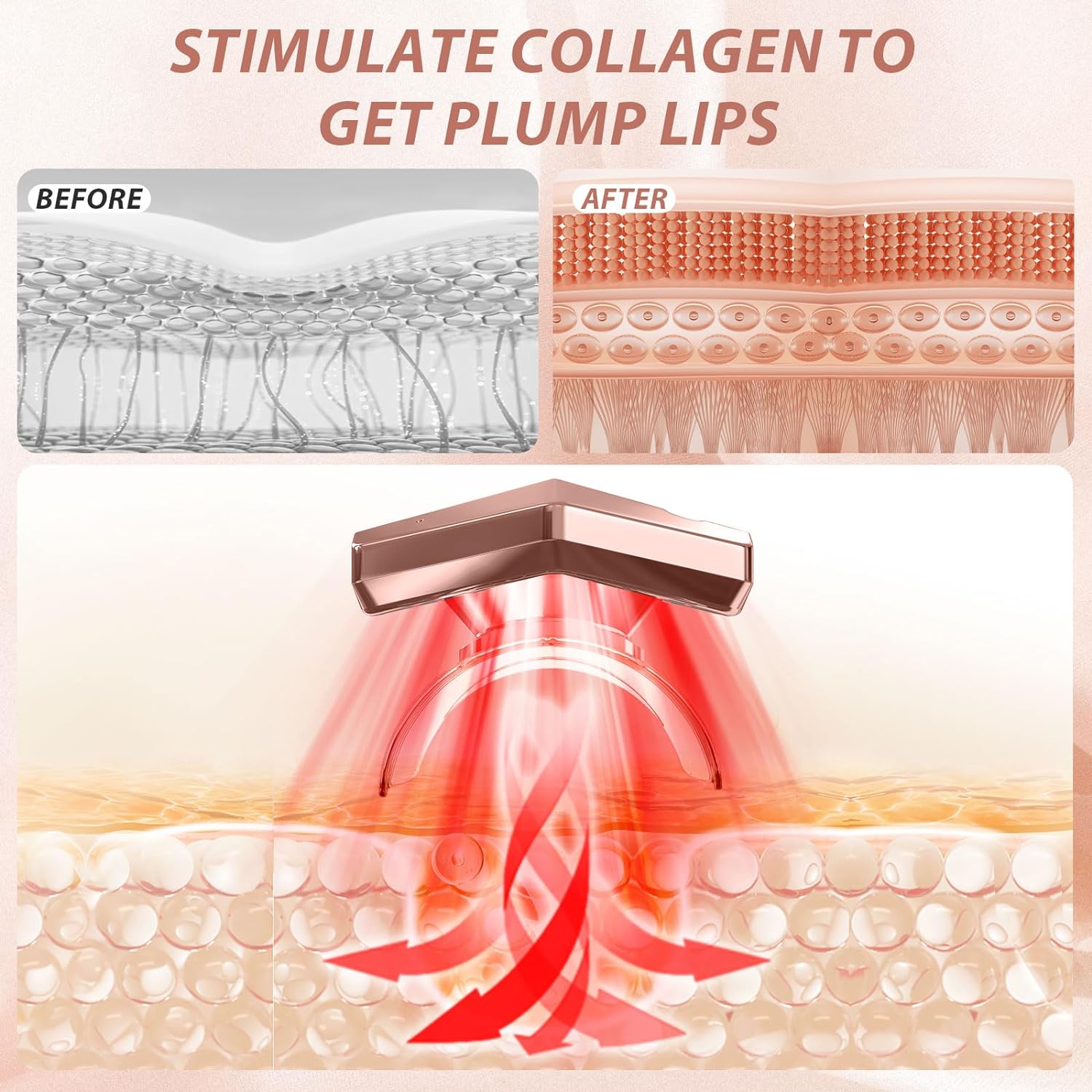 Infrared Light Therapy Lip Care Device