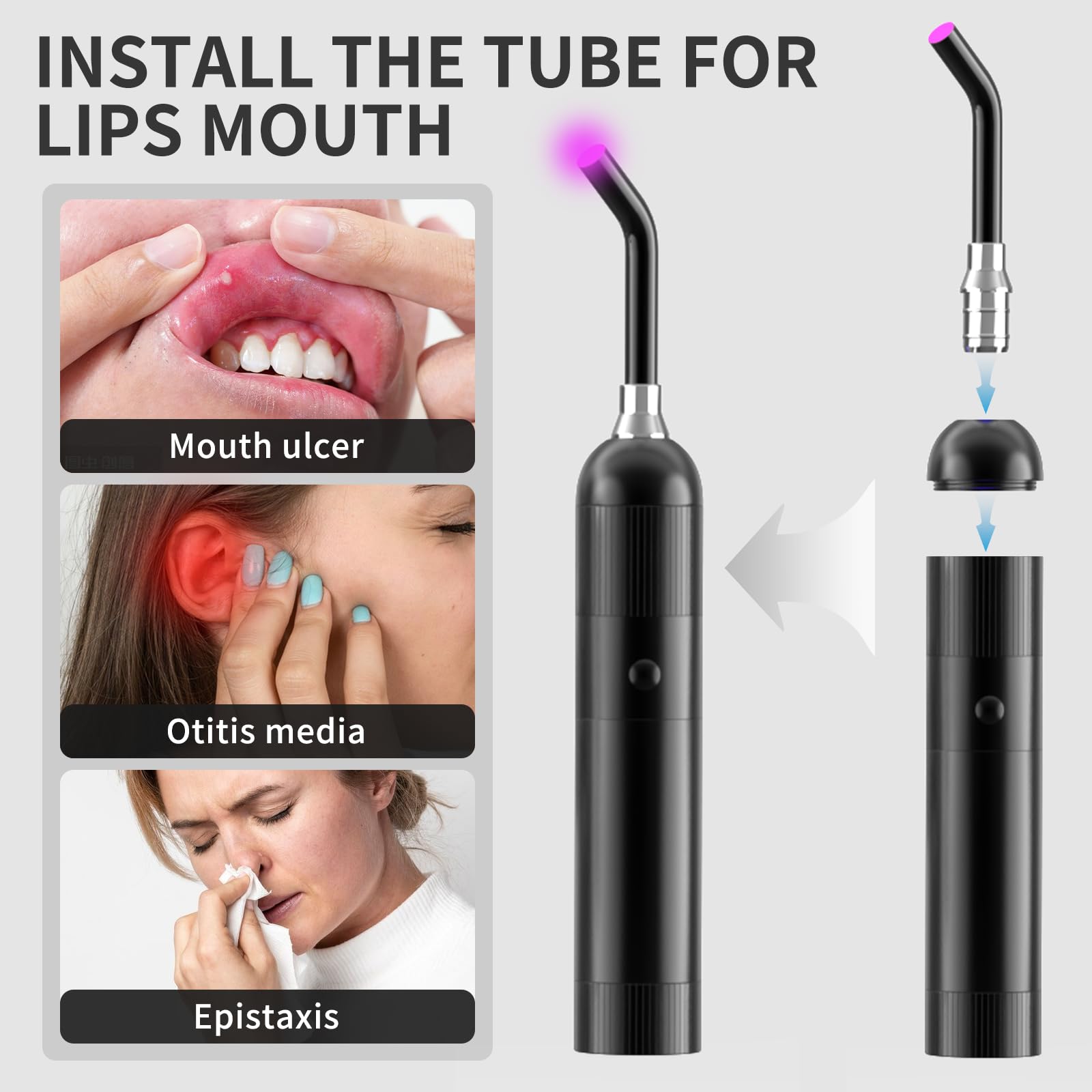 Red Light Oral Therapy Device