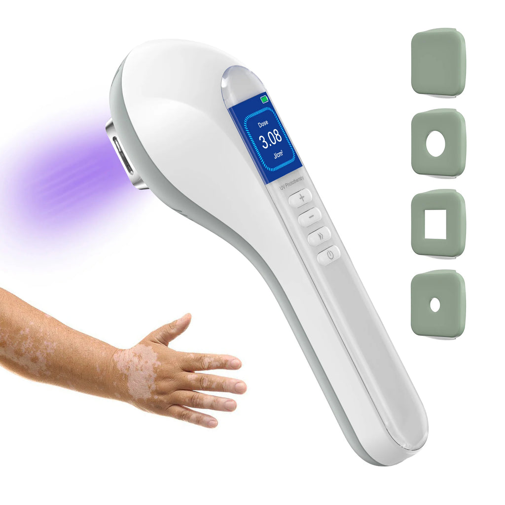 Handheld UVB Phototherapy Device for Vitiligo & Psoriasis - Portable 308nm Light Therapy Lamp by UVBtreatment