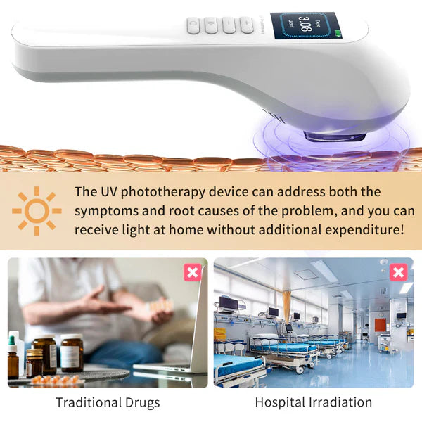 Handheld UVB Phototherapy Device for Vitiligo & Psoriasis - Portable 308nm Light Therapy Lamp by UVBtreatment