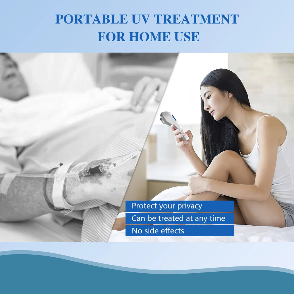 Handheld UVB Phototherapy Device for Vitiligo & Psoriasis - Portable 308nm Light Therapy Lamp by UVBtreatment