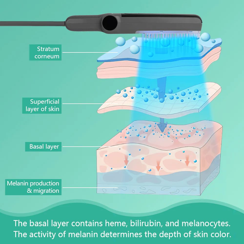 Philips Narrowband UVB Phototherapy Panel - Medical Grade 311nm Light Therapy for Vitiligo & Psoriasis Treatment at Home