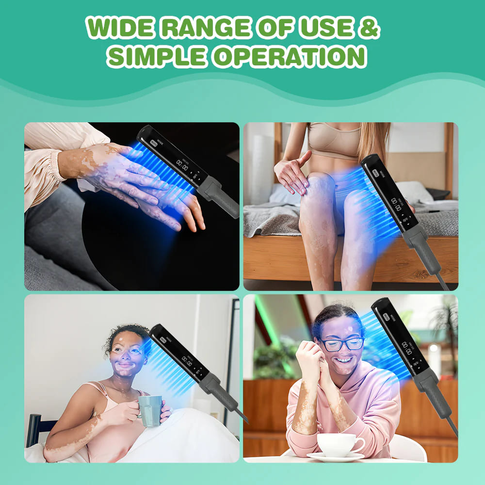 Philips Narrowband UVB Phototherapy Panel - Medical Grade 311nm Light Therapy for Vitiligo & Psoriasis Treatment at Home