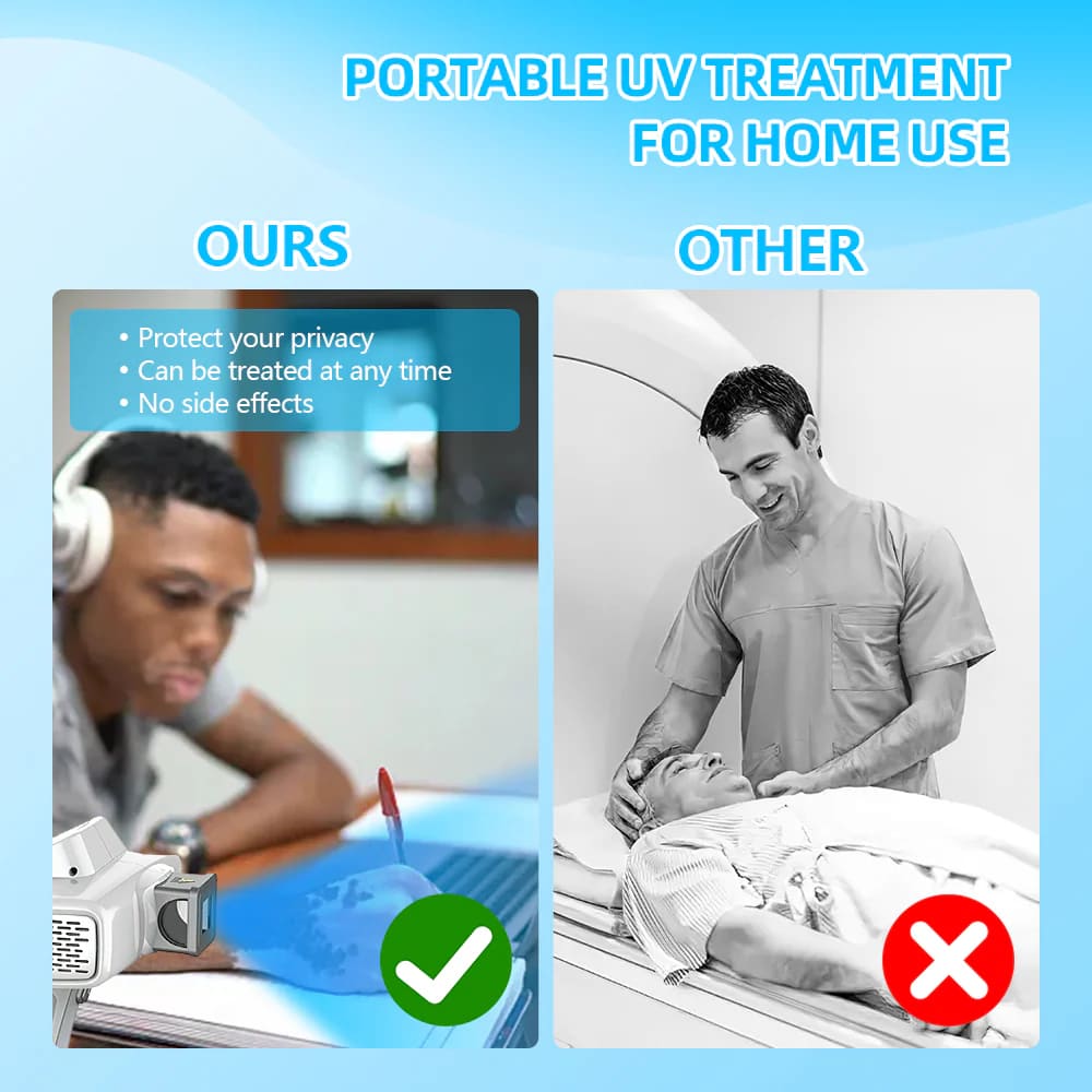Targeted 308nm Excimer Lamp for Vitiligo & Psoriasis - Focused UVB Phototherapy Device for Home Use