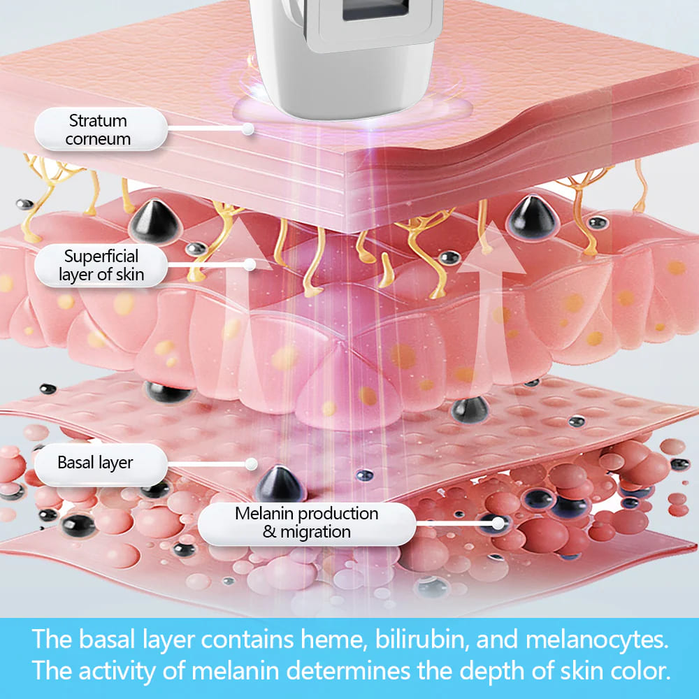 Targeted 308nm Excimer Lamp for Vitiligo & Psoriasis - Focused UVB Phototherapy Device for Home Use